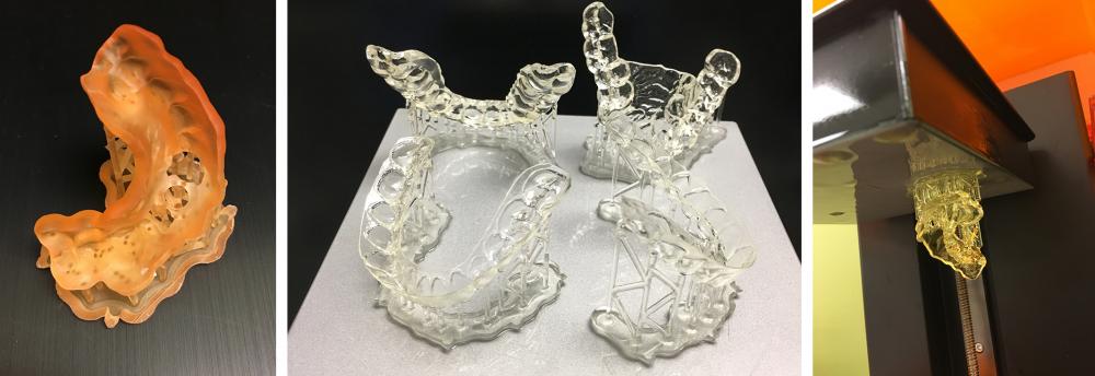 3D-printed mouth guards (center), 3D printer (right) and an in-production 3D-printed surgical guide (left), all from Dr. Bencharit’s lab. Photos by Dr. Sompop Bencharit, VCU Health.