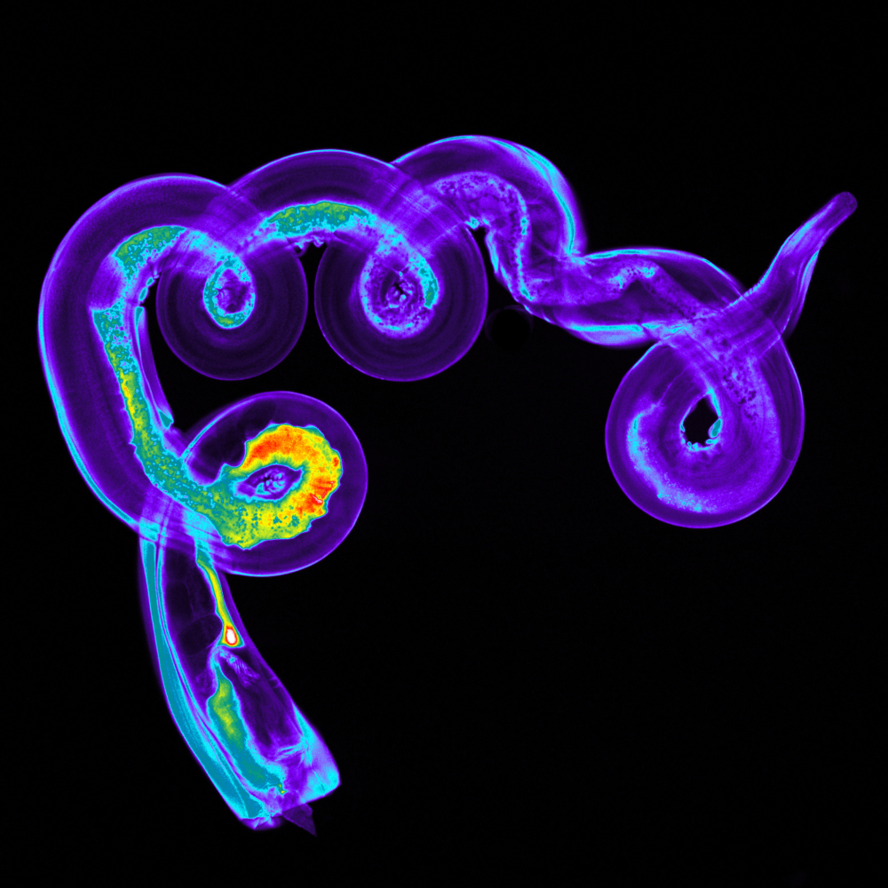 helminth