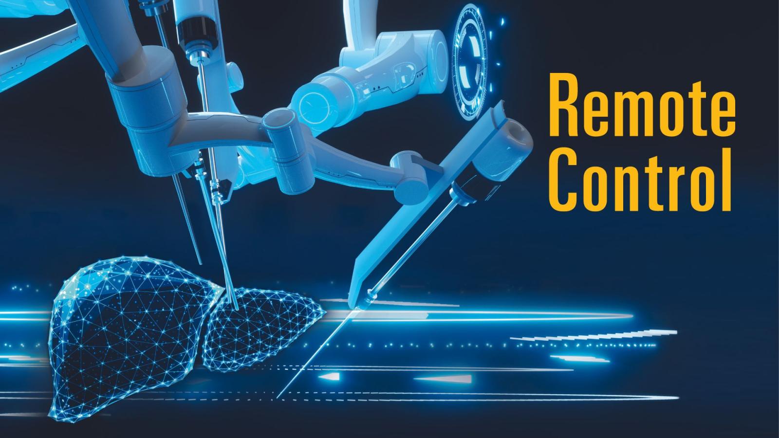 Remote Control: Bringing Robotic Surgery to Living Donors | Medical ...