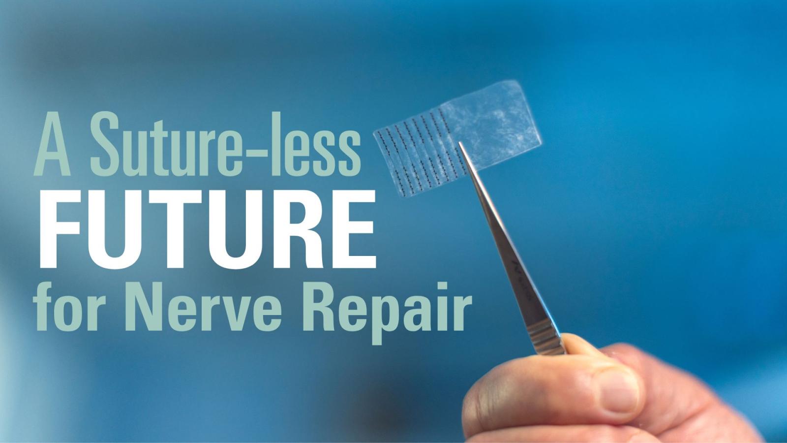 a sutre-less future for nerve repair